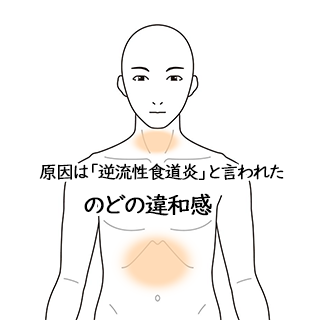 原因は「逆流性食道炎」と言われた、のどの違和感